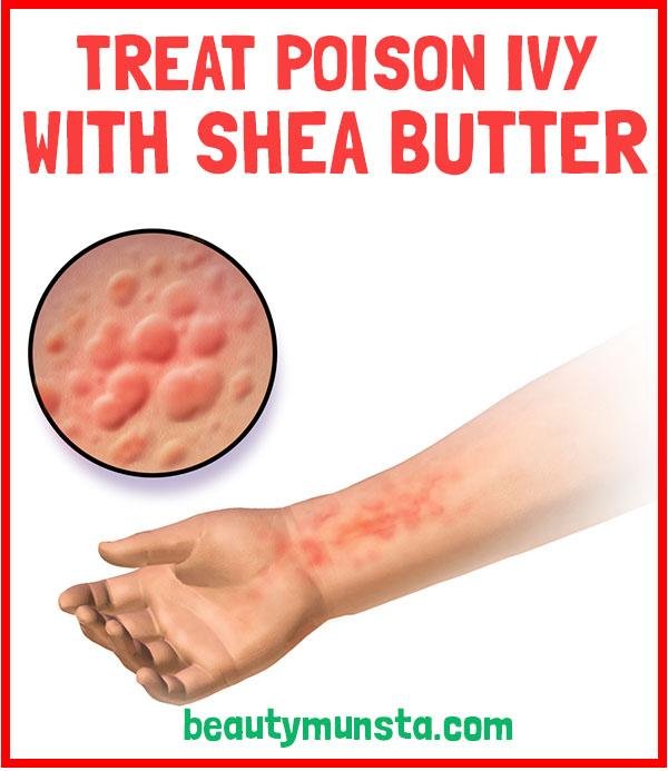 bơ hạt mỡ để giảm độc cho cây thường xuân