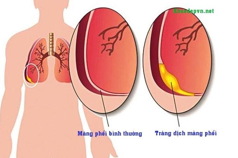 lao-mang-phoi