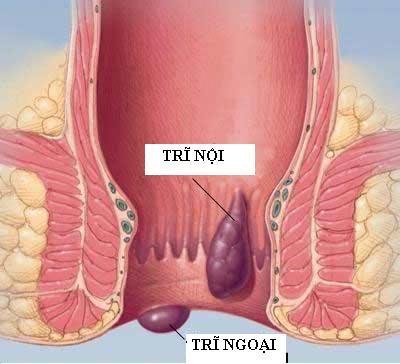 benh-tri-khi-mang-thai